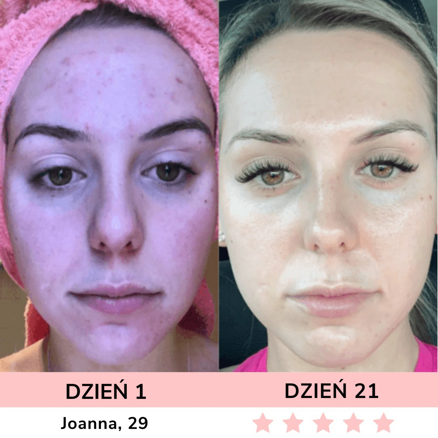 GLOW LANE – Urządzenie do pielęgnacji twarzy LED 7w1