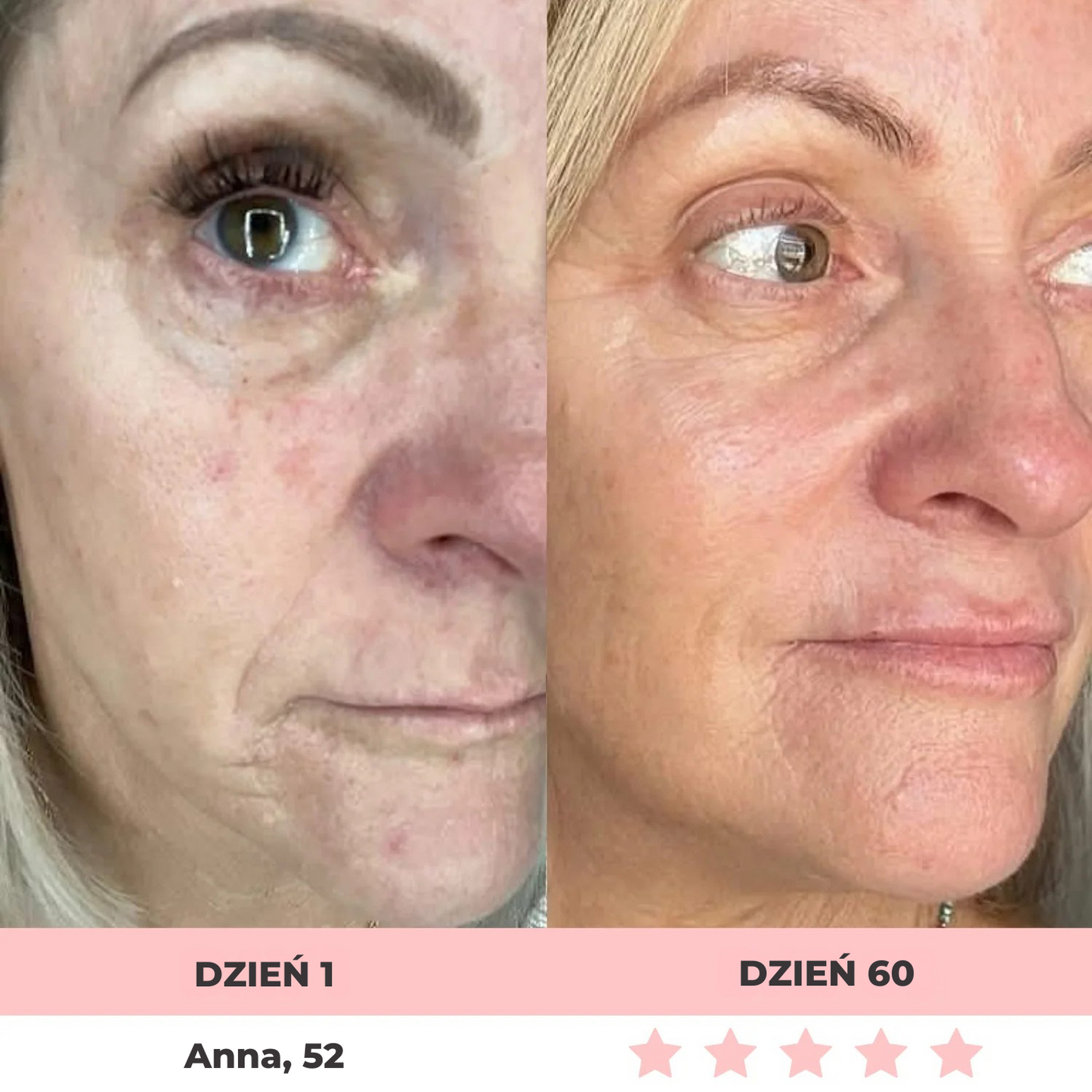 GLOW LANE – Urządzenie do pielęgnacji twarzy LED 7w1