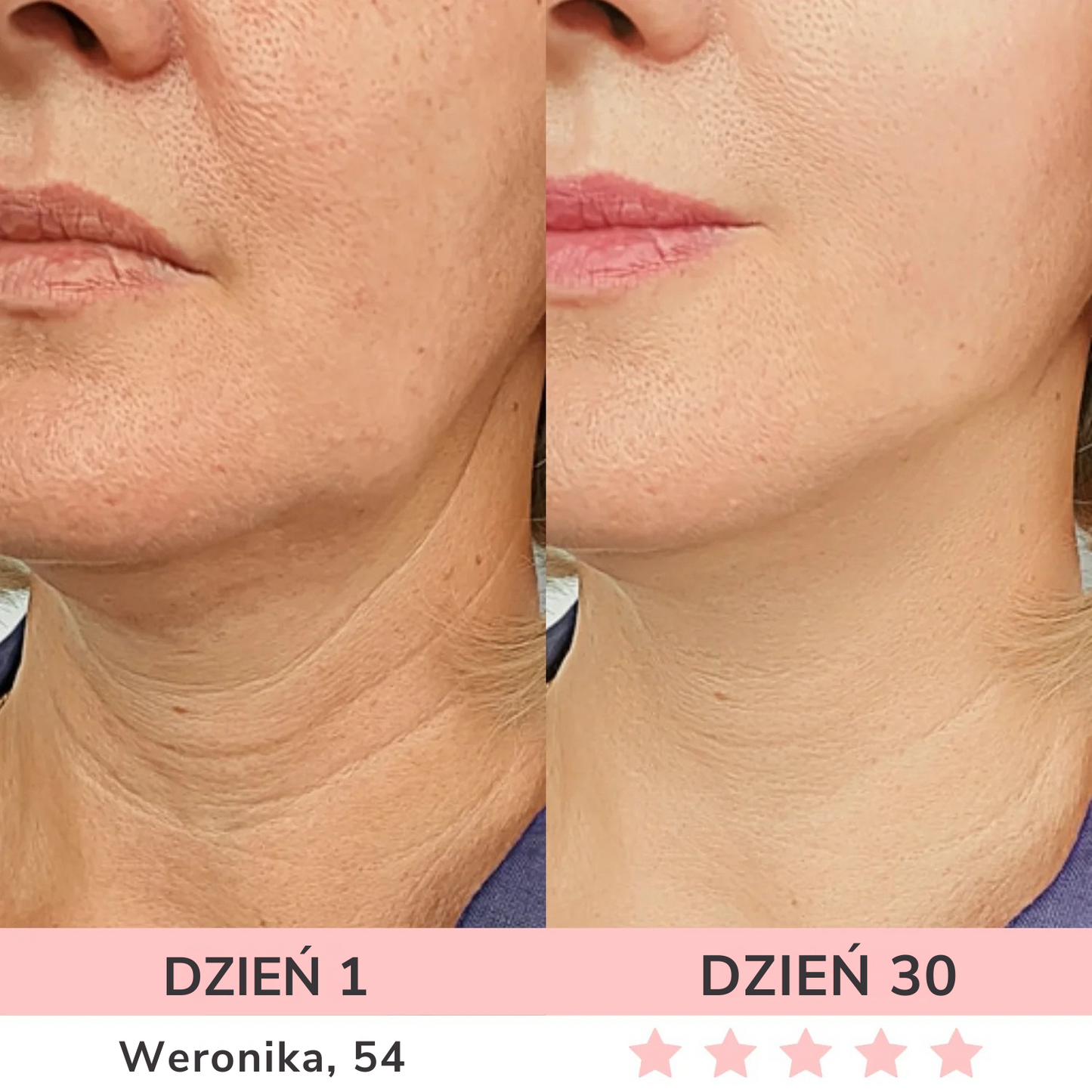 GLOW LANE – Urządzenie do pielęgnacji twarzy LED 7w1