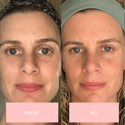 Maska na twarz GlowLane LED 7-w-1